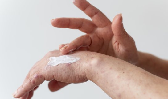 Tips and Products For Preventing Dry Skin 