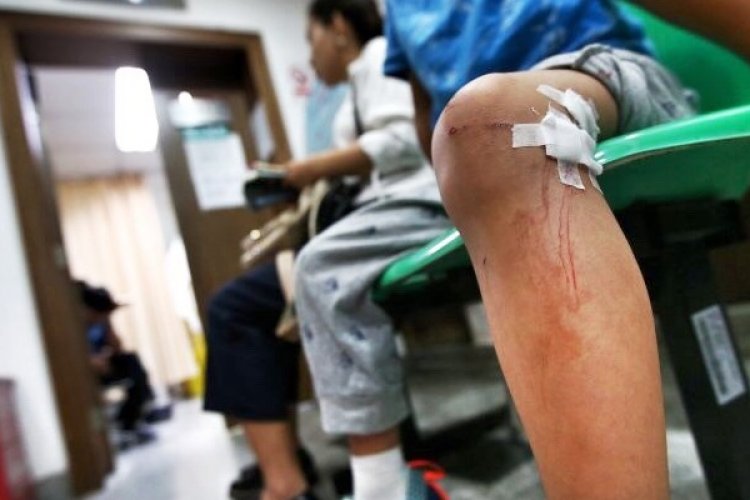 dog scratch cause rabies