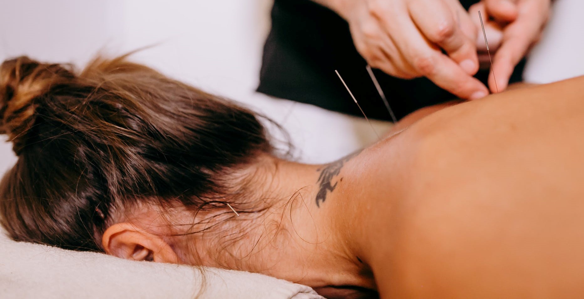 A Skeptic’s Adventures in Acupuncture